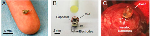 図1　体内に埋め込む超小型無線マイクロカプセル　出典：Stanford University